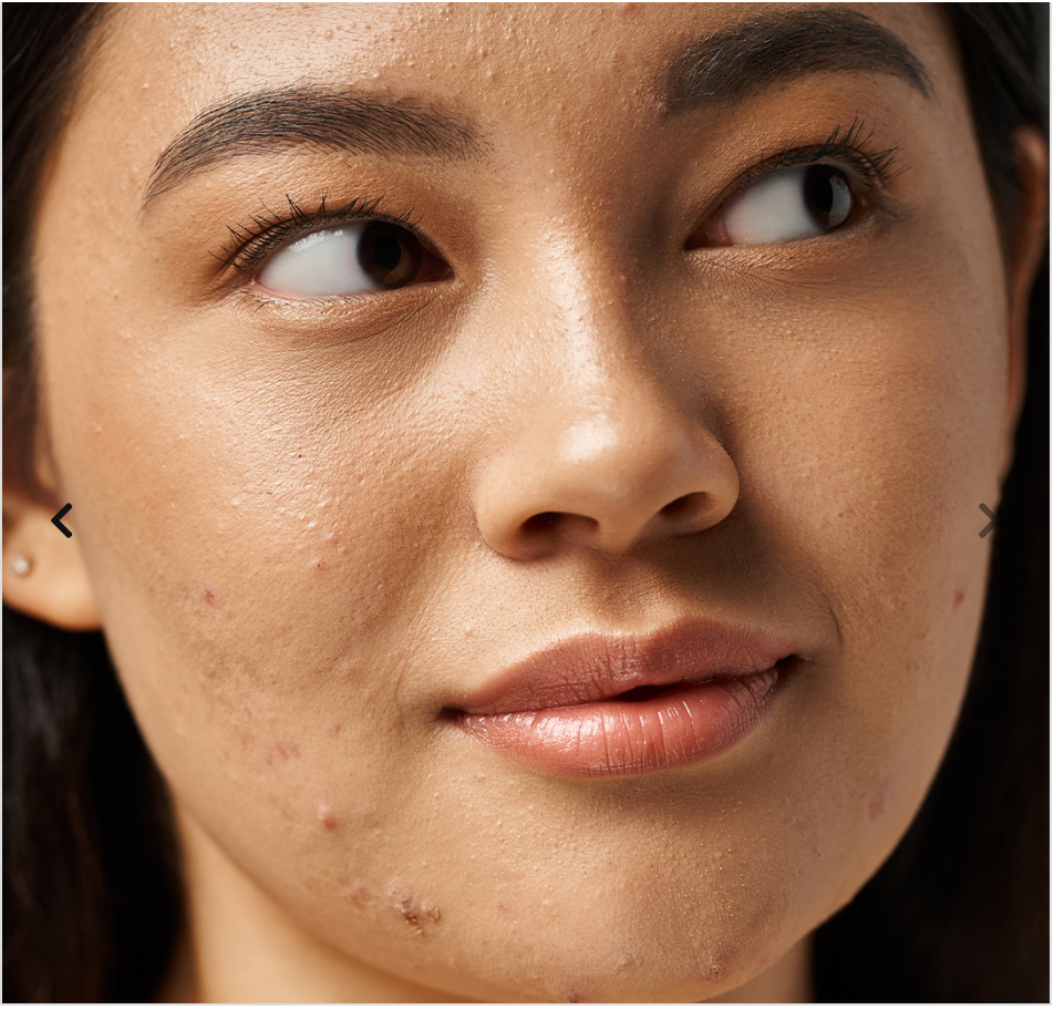 SKIN PURE-Complément Alimentaire Beauté & Pureté