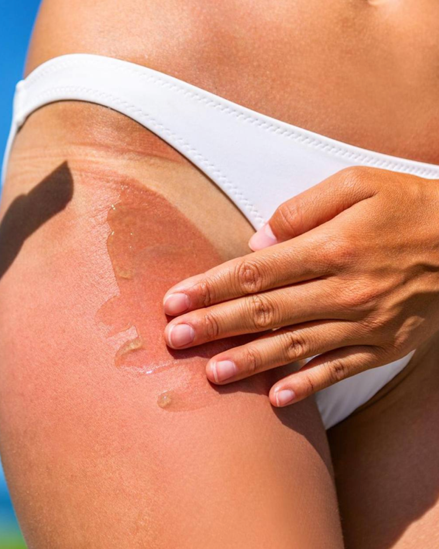 Spray apaisant après-soleil